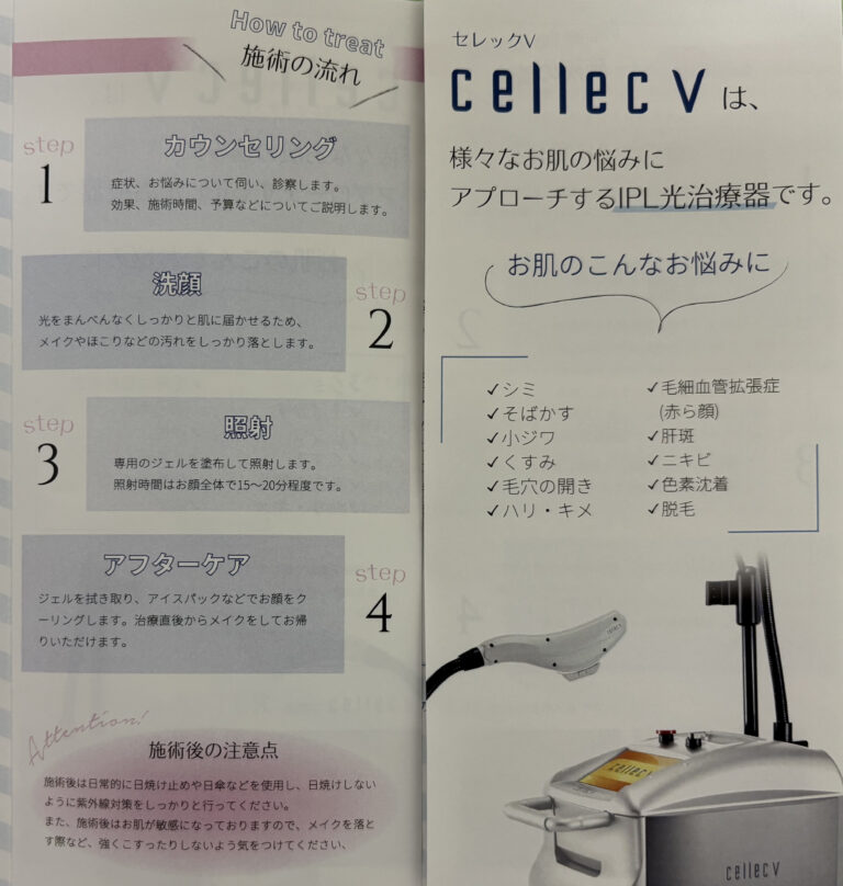 セレックVの案内