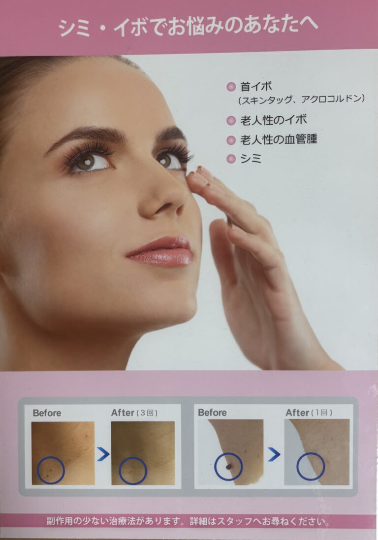 デルマトロンの案内